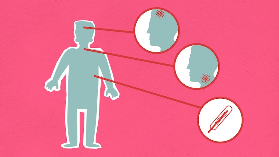 Cartoon diagram showing the signs of infection, including a headache and sore throat